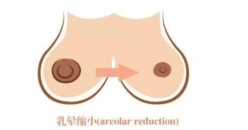 長沙激光美容醫(yī)院哪家好？探尋長沙地區(qū)激光美容行業(yè)領(lǐng)軍者