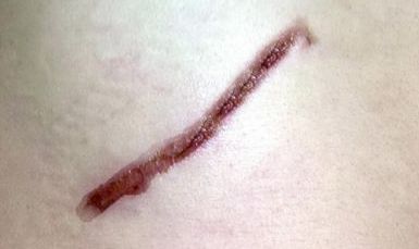 云南青少年減肥哪家好？探索云南地區(qū)青少年瘦身好方法