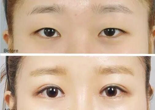 成都眼科醫(yī)院眼睛縫針技術如何？排名靠前的醫(yī)院有哪些？