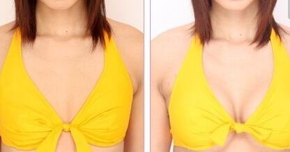 李健寧顱面裂畸形修復(fù)效果如何？想了解的人快來(lái)看！