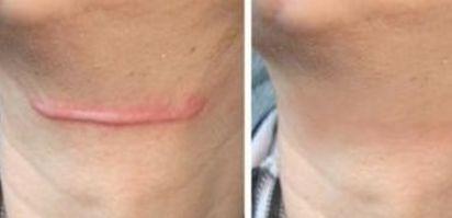 上海哪家醫(yī)院治療皮膚色素斑好？