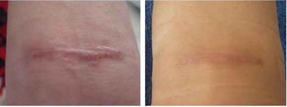 大連哪家眼科醫(yī)院提供修復外眼角最好的服務？