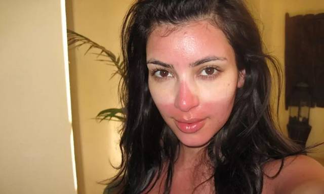 2023黑龍江注射去抬頭紋正規(guī)專家口碑前幾(郭福林、宮立民、朱勝軍實(shí)力口碑)