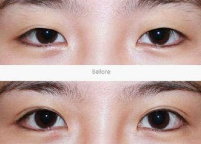 貴陽治療疤痕好的醫(yī)院排名及相關(guān)治療方法