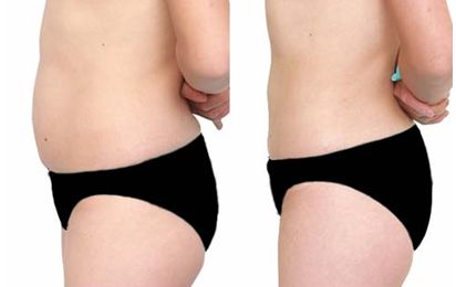 武漢哪家整形醫(yī)院的凸嘴技術(shù)好，值得信賴？