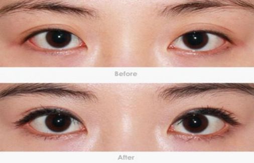 柳州哪家醫(yī)院做疤痕切除好？-獨家分享柳州疤痕切除醫(yī)院排行榜