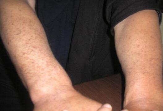 上海九院陳文杰醫(yī)生詳細介紹及成功案例分享