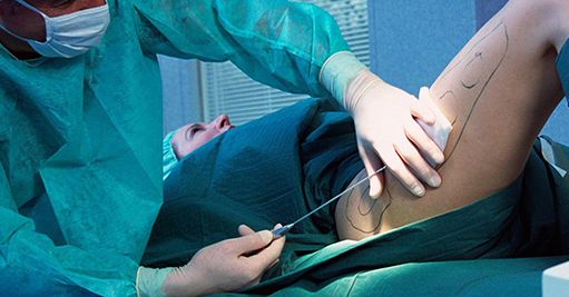 廣州美容整形醫(yī)院哪家好？推薦2023年評(píng)選的廣州頂尖美容整形醫(yī)院