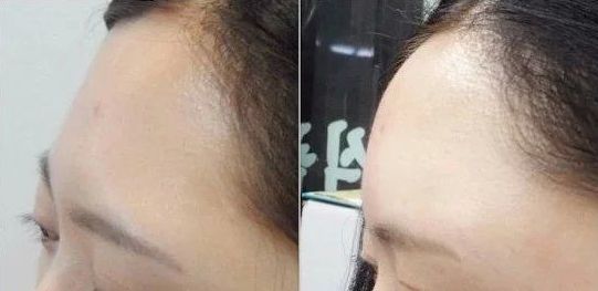 沈陽(yáng)私密整形去哪家好？專(zhuān)家推薦排行榜2023