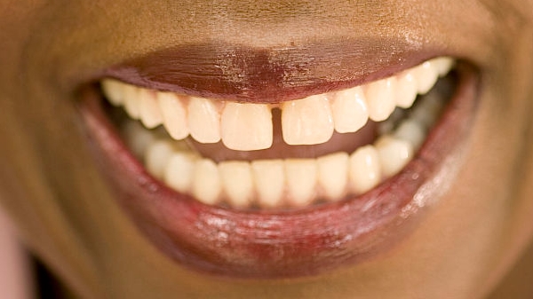 2023上海微雕去頸部皺紋正規(guī)醫(yī)生前十強(qiáng)(李東山、章慶國(guó)、曾高一定要收藏好)