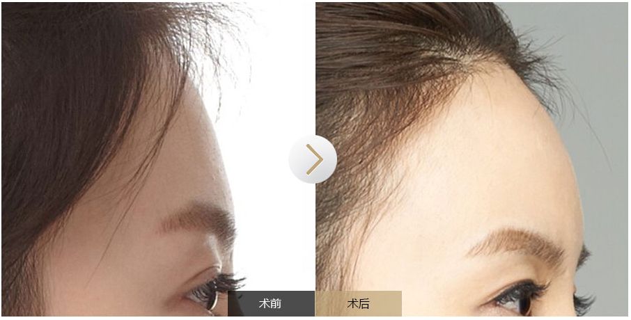 南寧點(diǎn)痣需求旺盛，哪家醫(yī)院是最受歡迎的？