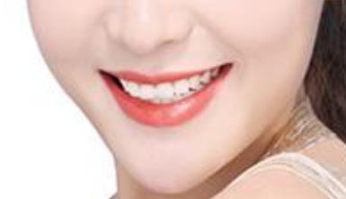 2023廈門電動負壓吸脂去雙下巴專家前10榜單(袁靜明、周璟、張俠網(wǎng)友親測好評名單分享！)