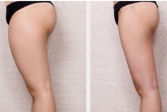 唐山哪家醫(yī)院整形科好？專家推薦，匯總唐山當(dāng)?shù)乜诒罴颜吾t(yī)院