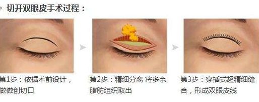 淮安光子嫩膚醫(yī)院哪家好？專家為您推薦5家權威醫(yī)院