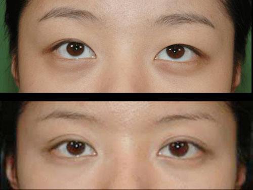 2023武漢冷凍法酒糟鼻治療top10的醫(yī)生(陳佳旭、馬超群、王介聰從實(shí)力看不輸公辦)