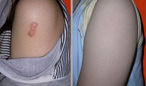 深圳隆下巴哪家醫(yī)院好？如何選擇合適的下巴整形醫(yī)院？