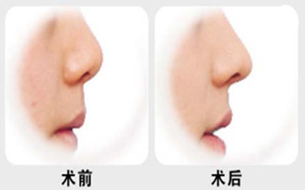 上海專業(yè)唇部整形五大口碑專家公布，人氣名醫(yī)張余光、周佳、戴傳昌等榜上有名