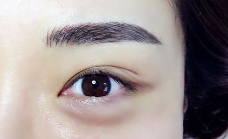 銀川有哪些專業(yè)的激光祛痘印醫(yī)院值得推薦？