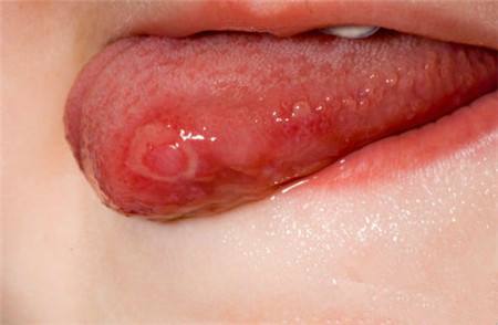 2023廈門微雕點(diǎn)陣去疤痕專家排行榜前十(陳俊光、郭佳穎、易朝華是私立收費(fèi)不貴還正規(guī))