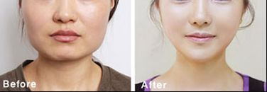 南昌熱瑪吉哪家醫(yī)院做得好？專(zhuān)業(yè)推薦南昌市xx醫(yī)院