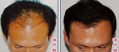 榆林醫(yī)專附屬醫(yī)院醫(yī)學(xué)整形美容中心怎么樣？榆林醫(yī)專附屬醫(yī)院醫(yī)學(xué)整形美容中心簡介|醫(yī)生團隊|口碑評價！