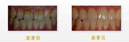 揭秘：武漢眼科醫(yī)生，他們的技術(shù)無人能敵！