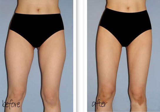 福州哪家整形醫(yī)院做下巴好？多年經(jīng)驗(yàn)專業(yè)醫(yī)生為您解答！