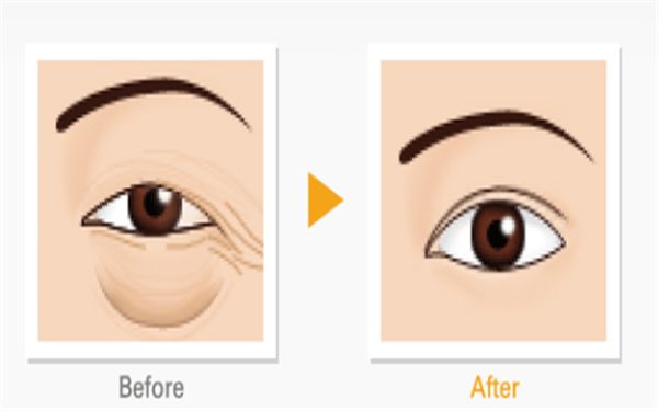 哈爾濱隆胸修復(fù)醫(yī)院排名及口碑對(duì)比，哪家專業(yè)又靠譜？