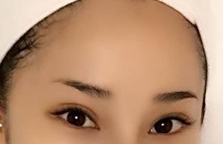 合肥哪家醫(yī)院臉部激光治療效果好，值得推薦？