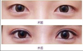 合肥美白針哪家醫(yī)院好？排名前幾位的合肥專業(yè)美膚診所推薦