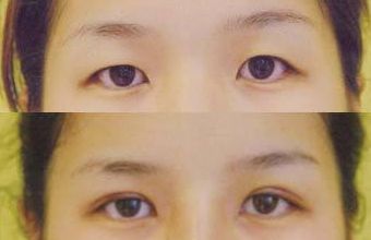 大慶微整形醫(yī)院哪家好？頂級專家為您解讀微整形醫(yī)院選擇指南！