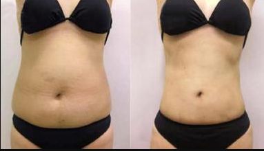 太原哪家醫(yī)院眼袋整形好？優(yōu)質(zhì)專家推薦