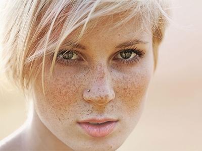 2023南京激光用祛痘印痘坑專家排行榜(陳明亮、陶野、金洪奭專業(yè)靠譜有實(shí)力！)