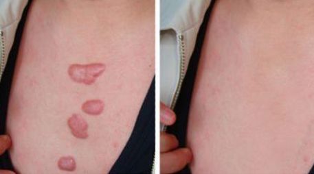 鄭州市哪家美容醫(yī)院好？優(yōu)質專業(yè)醫(yī)療服務等你來咨詢！