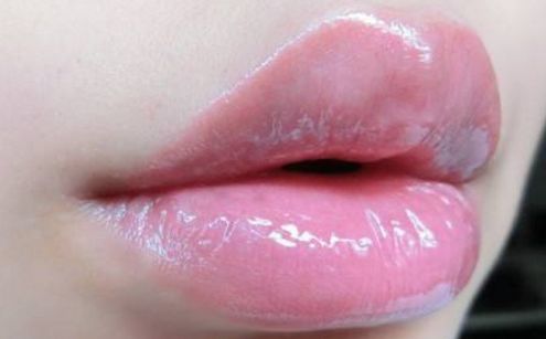 濟(jì)南哪家整形醫(yī)院口碑好？