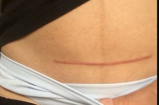 如何選擇新疆做胎記醫(yī)院，哪家好？