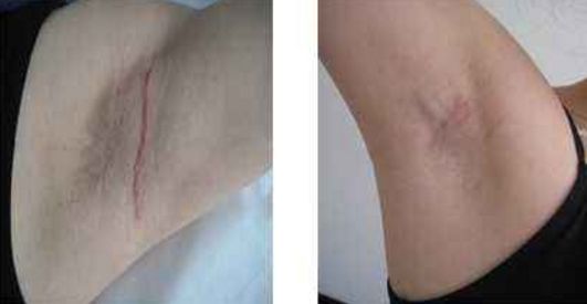 深圳激光美容醫(yī)院排名及口碑哪家好？