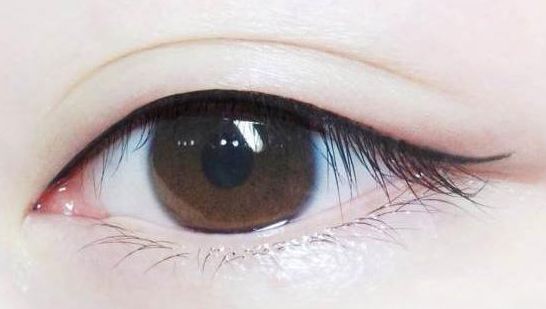 【長治哪家醫(yī)院祛痣效果好？專家推薦讓你放心選擇】