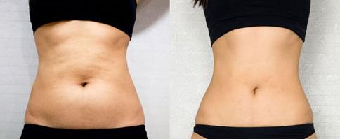 上海的隆胸醫(yī)生盤點！王濤、江華、何金光等出色醫(yī)師吸睛！