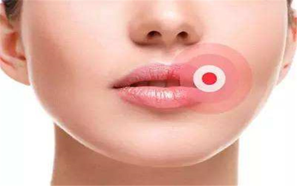 2023江門大拉皮去額頭紋專家TOP10排名榜(毛孝中、歐國(guó)升、王志軍三位大咖特點(diǎn)分析！)