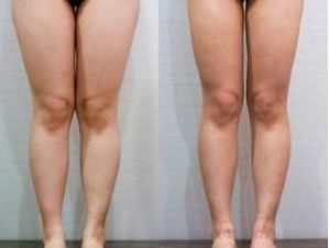 南京眼皮松弛醫(yī)院排名及口碑調(diào)查：哪家醫(yī)院是患者首選？