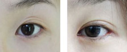 汕頭市整形醫(yī)院有哪些？哪家整形醫(yī)院在汕頭市口碑好？