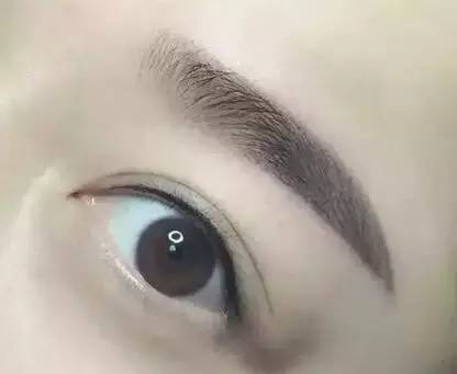 佰華利董萍的面部脂肪填充經(jīng)驗，展現(xiàn)自然少女感