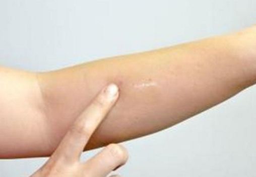 蘇州吸脂瘦身醫(yī)院哪家好？選個最適合你的專業(yè)醫(yī)療機構