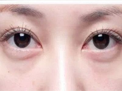 寧波祛斑哪家醫(yī)院好？精選寧波祛斑專業(yè)醫(yī)院推薦！