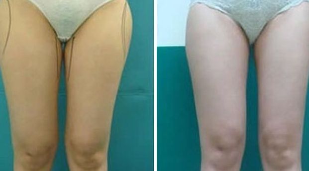 揭陽(yáng)激光美容醫(yī)院哪家好？選擇揭陽(yáng)最佳激光美容醫(yī)院的7個(gè)關(guān)鍵要素！