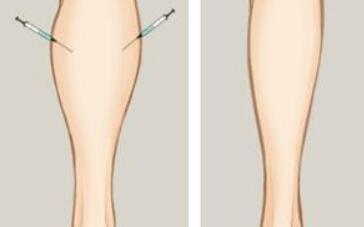 上海第九人民醫(yī)院美容外科專家介紹：劉菲、蘇薇潔領(lǐng)軍，醫(yī)術(shù)出眾！