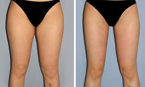 重慶美萊整形美容醫(yī)院口碑如何？醫(yī)生名單和特色項目都有什么？