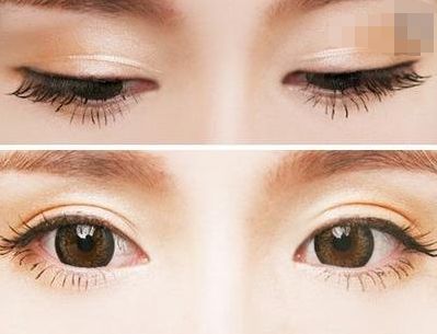 西寧豐胸整形醫(yī)院排名前三，專業(yè)醫(yī)生推薦！