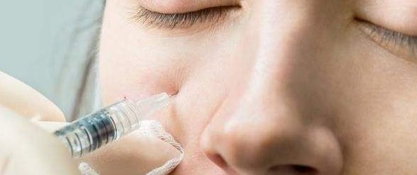 西安哪家醫(yī)院激光去斑效果最好？